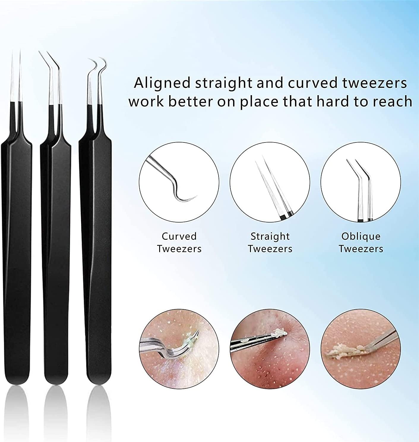 Pimple Popper Tool Kit 11 Pcs,  Blackhead Remover Pimple Extractor Tools with Metal Case for Quick and Easy Removal of Blackheads,Pimples,Whiteheads,Zit Popper,Forehead,Facial and Nose (Black)